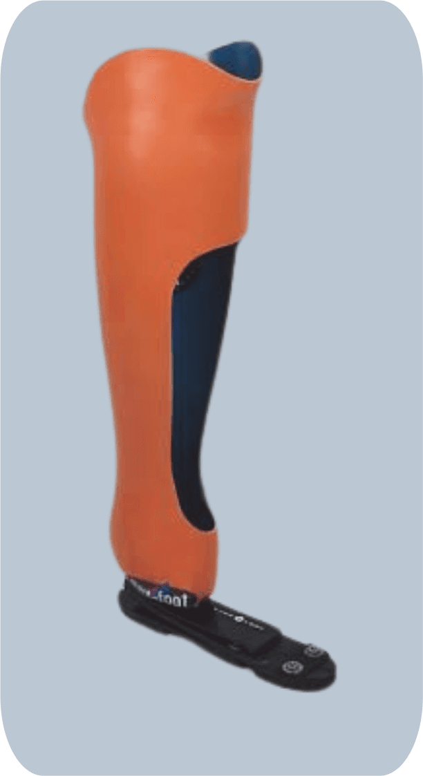 Ankle Disarticulation Prosthesis