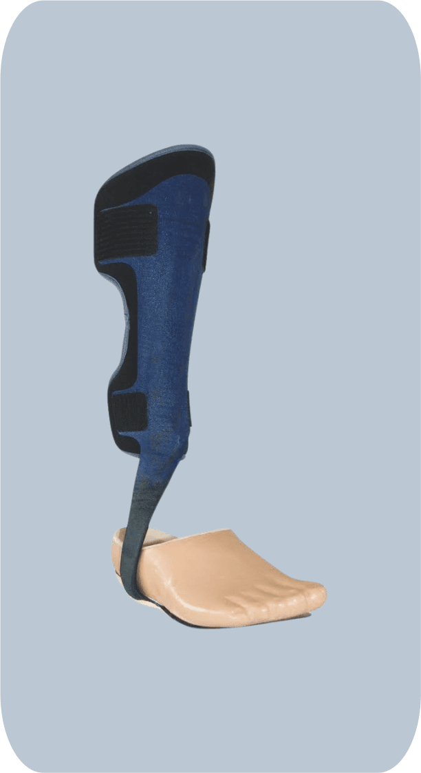 Partial Foot Prosthesis
